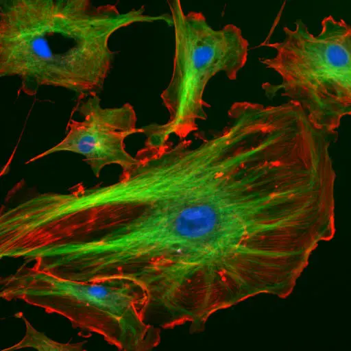 Fluorescent cells under a microscope, green nuclei and red structure against a dark field.